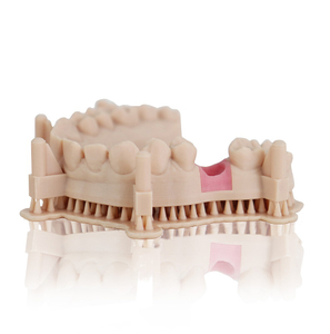 Dental-Model-Beige-with-signal-implant