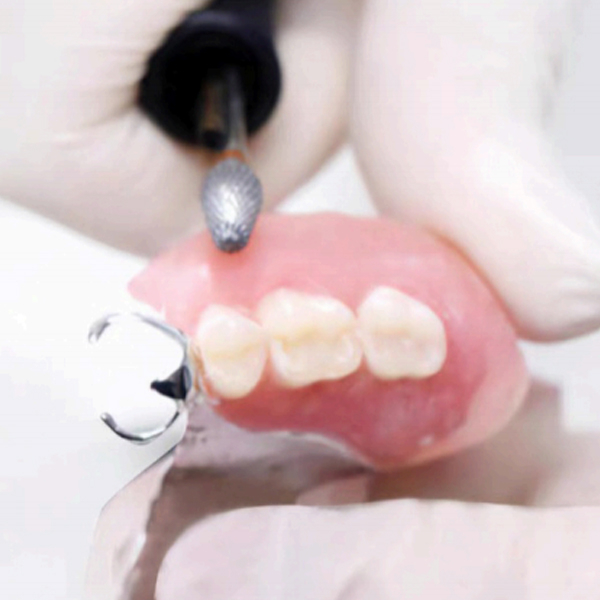 Denture base photosensitive resin Wear resistance