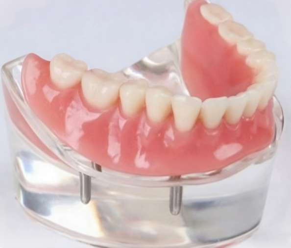 Model Display of 3D Printing Denture Base 